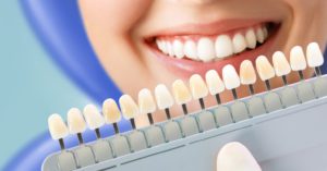 teeth whitening in Wellington